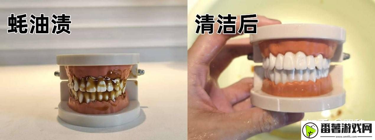 2025年口腔护理新宠！知乎大咖力荐欧可林airpump