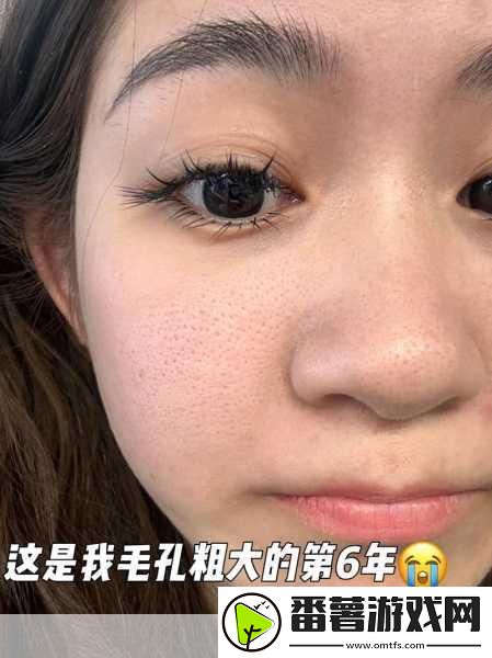 粗大黑头紫大黑头紫挤进