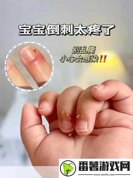 宝宝怎么才三根手指就痛